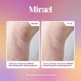 Smoothing After Waxing Serum - Travel Size (10ml)